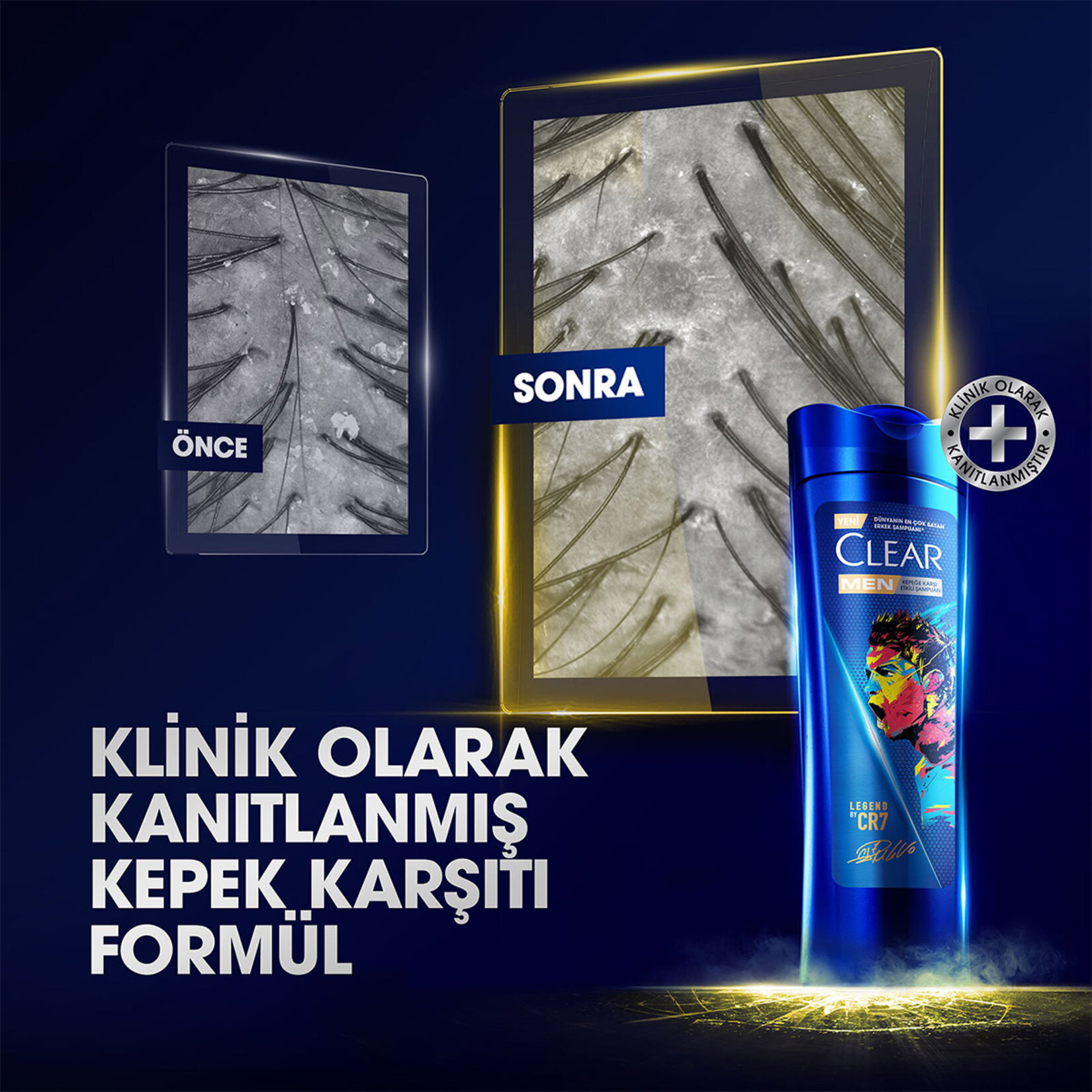 Clear Men Kepeğe Karşı Etkili Şampuan Legend By CR7 Cristiano Ronaldo 350 ml - Görsel 4