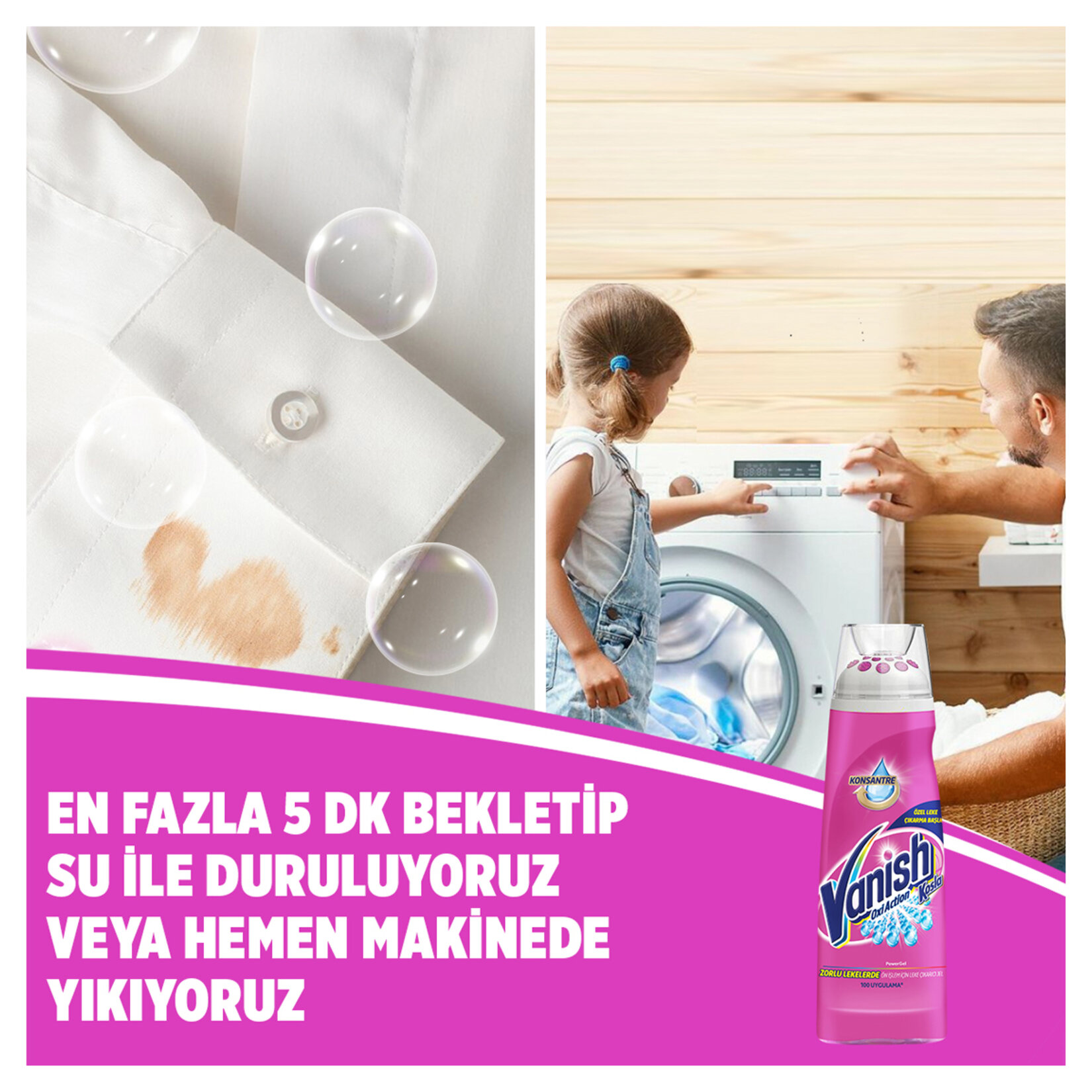 Vanish Kosla Ön İşlem İçin Leke Çıkarıcı Jel 200 Ml - Görsel 5