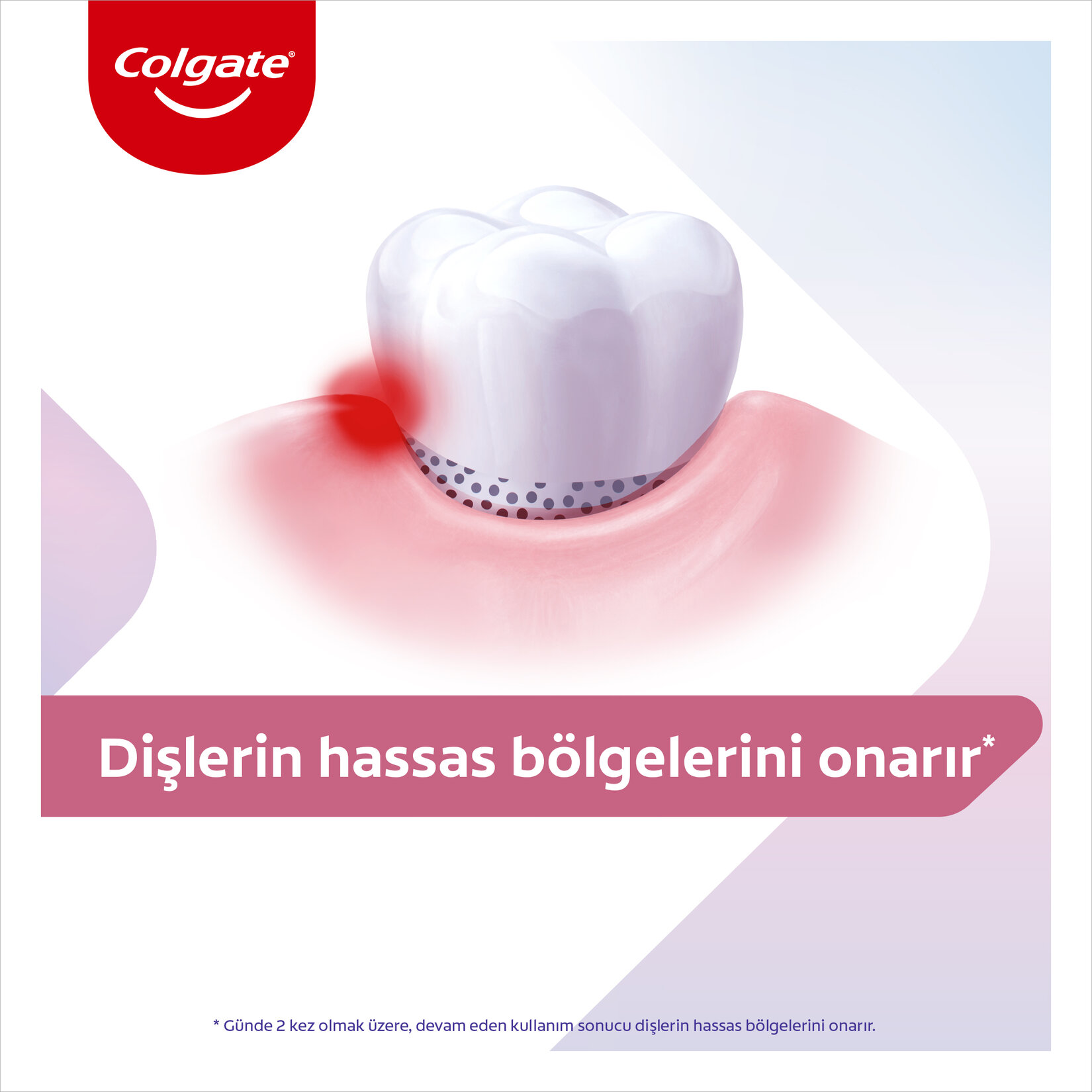 Colgate Hassasiyete Anında Çözüm Onarım ve Diş Eti Bakımı Diş Macunu 75 ml - Görsel 3
