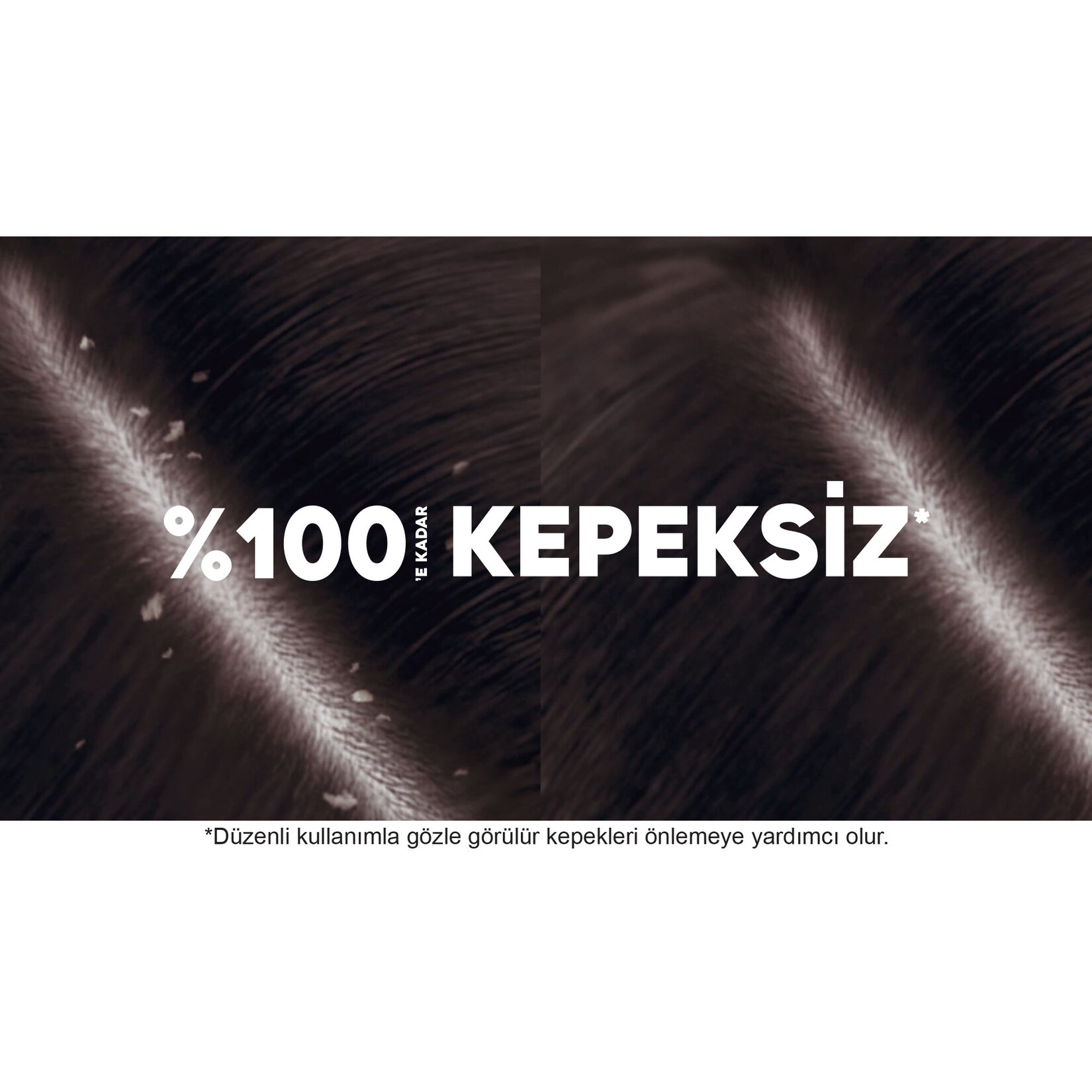 Head & Shoulders Klasik Bakım 2in1 Kepeğe Karşı Etkili Şampuan 250 Ml - Görsel 4