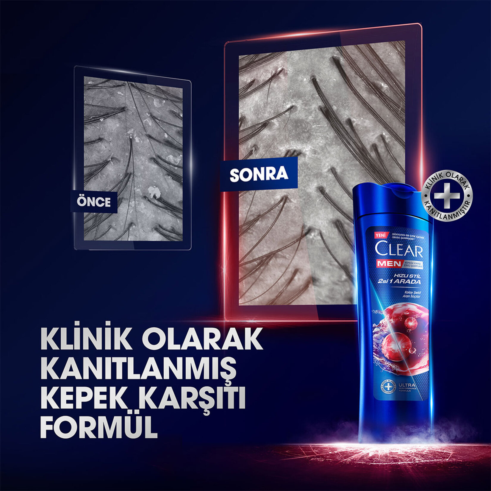 Clear Men Kepeğe Karşı Etkili Şampuan Hızlı Stil 2'si 1 Arada Kolay Şekil Alan Saçlar 350 ml - Görsel 4