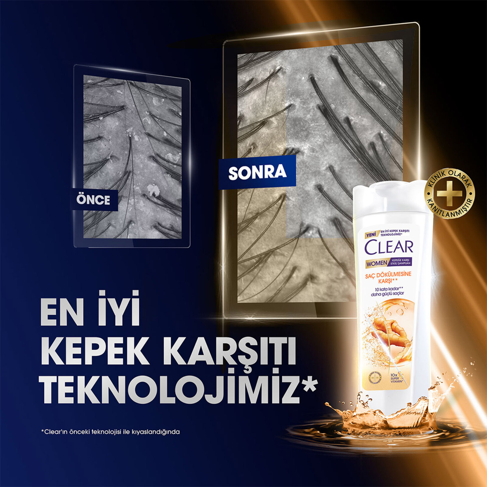 Clear Women Kepeğe Karşı Etkili Şampuan Saç Dökülmesine Karşı Zencefil Özü 350 ml - Görsel 4