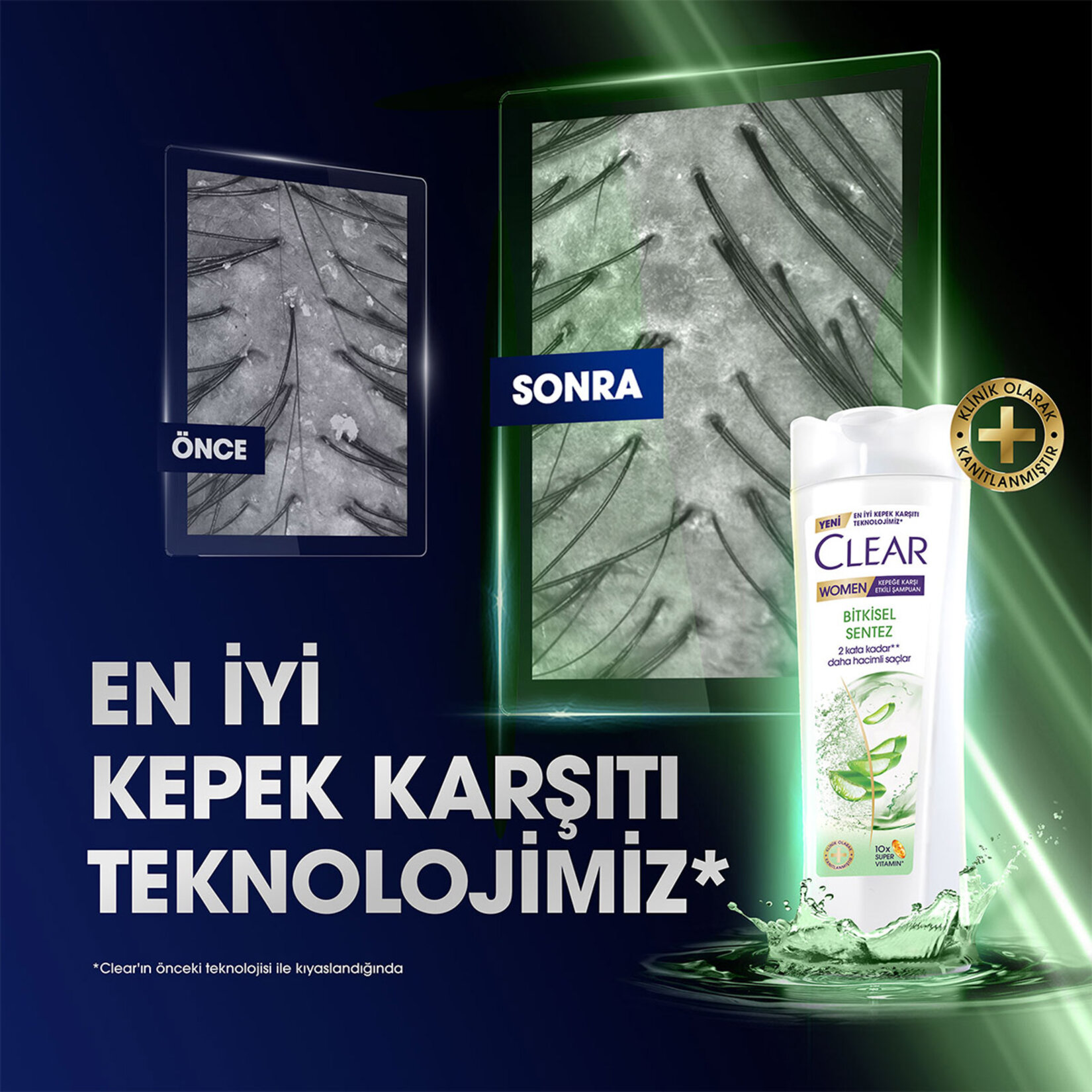 Clear Women Kepeğe Karşı Etkili Şampuan Bitkisel Sentez Aloe Vera & Çay Ağacı Yağı 350 ml - Görsel 4