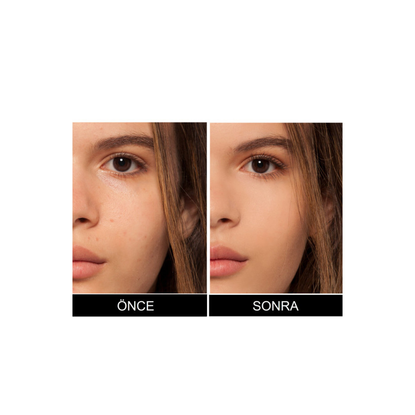 L'Oréal Paris True Match Kapatıcı 2R/C Rose Vanilla - Görsel 4