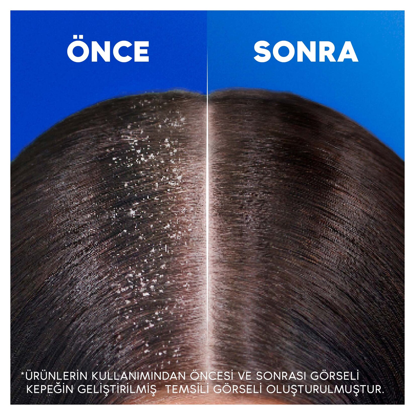 Head & Shoulders Şampuan Nemlendirici Akım 1in1 330 Ml - Görsel 5