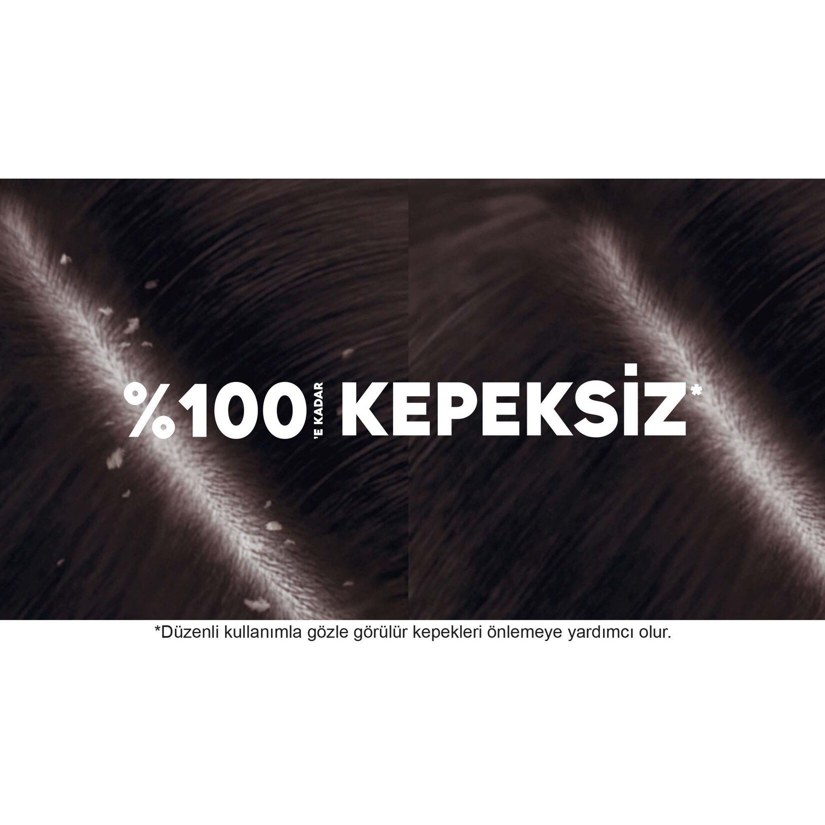 Head & Shoulders Kadınlara Özel Dökülme Karşıtı Kepeğe Karşı Etkili Şampuan 350 Ml - Görsel 4