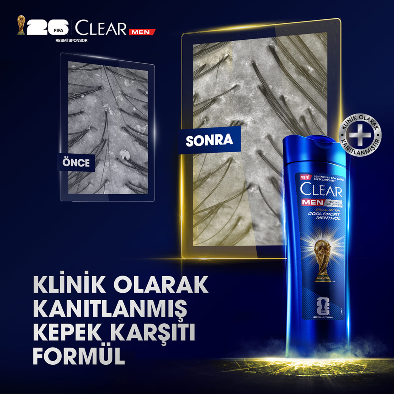 Clear Men Kepeğe Karşı Etkili Şampuan Cool Sport Menthol Ferahlatıcı Mentol Etkisi 350 ml - Görsel 4