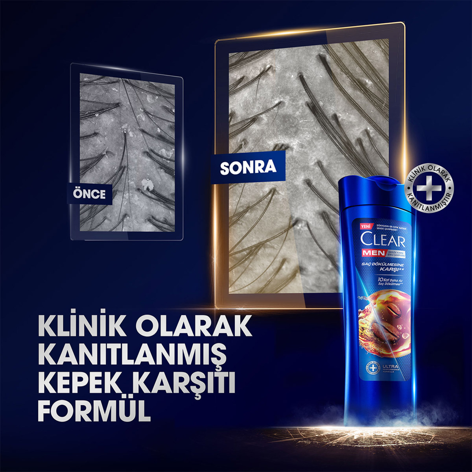 Clear Men Kepeğe Karşı Etkili Şampuan Saç Dökülmesine Karşı Kahve Çekirdeği Özü 350 ml - Görsel 3