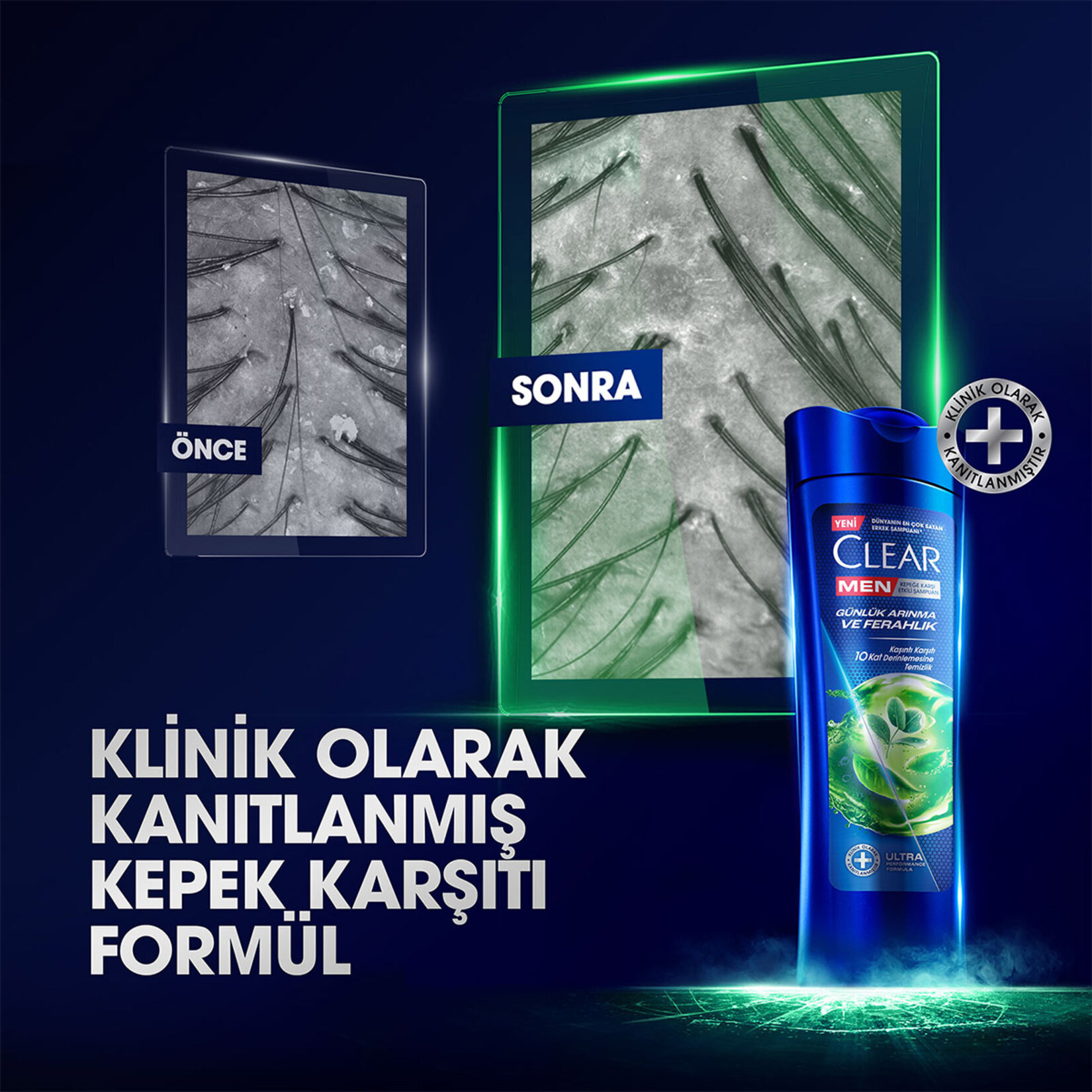 Clear Men Kepeğe Karşı Etkili Şampuan Günlük Arınma ve Ferahlık Sedir Ağacı ve Okaliptus Özleri 350 ml - Görsel 4