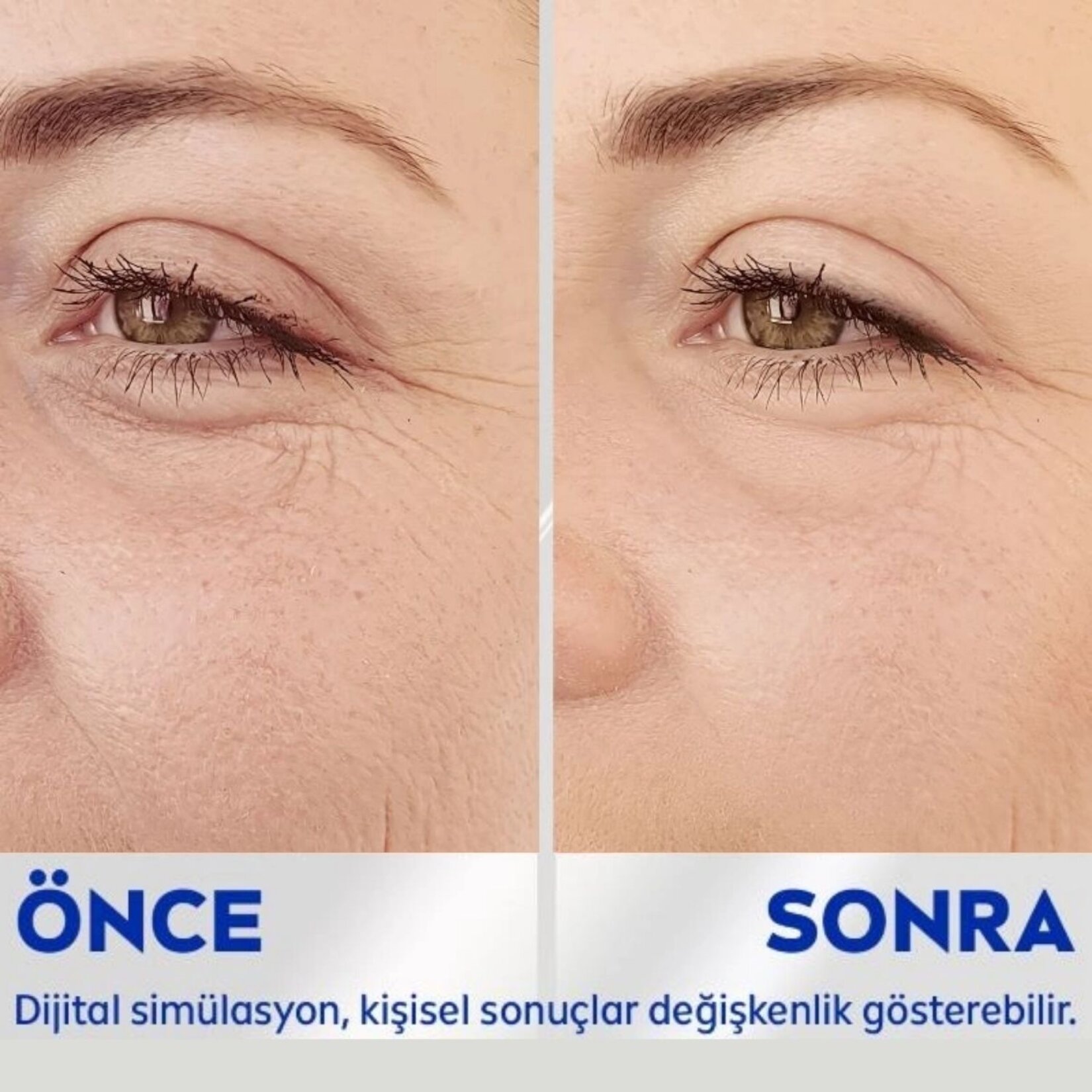 NIVEA Q10 Kırışık Karşıtı Sıkılaştırıcı Göz Bakım Kremi 15 ml - Görsel 4